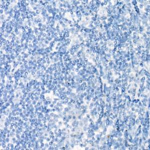 Immunohistochemistry analysis of paraffin-embedded human tonsil (negative control sample) using Anti-PAX8 Antibody [ARC55538] (A305642) at a dilution of 1:300 (40x lens) Perform high pressure antigen retrieval with 10 mM citrate buffer pH 60 before commencing with IHC staining protocol