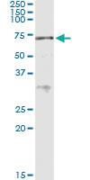 Anti-ACD Polyclonal Antibody Pair