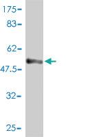 Anti-STX6 Mouse Monoclonal Antibody [clone: 1G2]