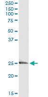 Anti-EDN3 Antibody Pair