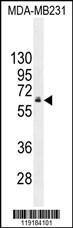 Anti-HNF1B Rabbit Polyclonal Antibody (APC (Allophycocyanin))