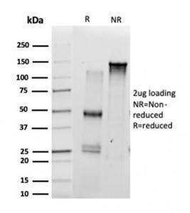 SDS-PAGE analysis of Anti-SCXA Antibody [PCRP-SCXA-1D2] under non-reduced and reduced conditions; showing intact IgG and intact heavy and light chains, respectively. SDS-PAGE analysis confirms the integrity and purity of the antibody