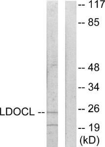 Anti-LDOC1L Rabbit Polyclonal Antibody