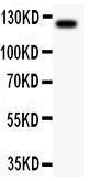 Anti-TIE2 Polyclonal Antibody