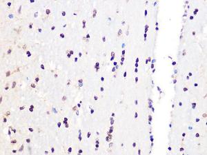 Immunohistochemistry analysis of paraffin-embedded rat brain using Anti-PCIF1 Antibody (A306951) at a dilution of 1:100 (40X lens). Perform microwave antigen retrieval with 10 mM Tris/EDTA buffer pH 9.0 before commencing with IHC staining protocol