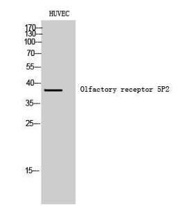 Western blot analysis of HUVEC cells using Anti-OR5P2 Antibody