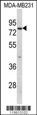 Anti-RANBP9 Rabbit Polyclonal Antibody