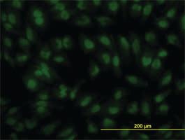 Anti-IRF2 Mouse Monoclonal Antibody [clone: 3B5]