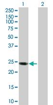 Anti-APOL1 Rabbit Polyclonal Antibody