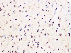 Immunohistochemistry analysis of paraffin-embedded mouse spinal cord using Anti-PCIF1 Antibody (A306951) at a dilution of 1:100 (40X lens). Perform microwave antigen retrieval with 10 mM Tris/EDTA buffer pH 9.0 before commencing with IHC staining protocol