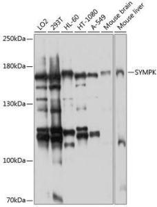 Western blot analysis of extracts of various cell lines, using Anti-Symplekin Antibody (A12296) at 1:1,000 dilution