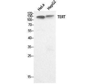 Western blot analysis of HeLa, HepG2 cells using Anti-TERT Antibody