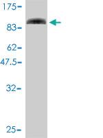 Anti-SLU7 Mouse Monoclonal Antibody [clone: 1D3-4A10]