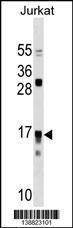 Anti-IL17RC Rabbit Polyclonal Antibody (HRP (Horseradish Peroxidase))