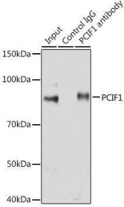 Immunoprecipitation analysis of 200µg extracts of Jurkat cells using 3 µg of Anti-PCIF1 Antibody (A306951). This Western blot was performed on the immunoprecipitate using Anti-PCIF1 Antibody (A306951) at a dilution of 1:1000