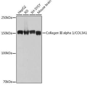 Western blot analysis of extracts of various cell lines, using Anti-Collagen III Antibody [ARC2542] (A308101) at 1:1,000 dilution The secondary antibody was Goat Anti-Rabbit IgG H&L Antibody (HRP) at 1:10,000 dilution Lysates/proteins were present at 25 µg per lane