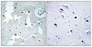 Immunohistochemical analysis of paraffin-embedded human brain using Anti-PARK7 Antibody 1:100 (4°C overnight). The right hand panel represents a negative control, where the antibody was pre-incubated with the immunising peptide