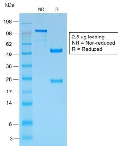 SDS-PAGE analysis of Anti-Melanoma gp100 Antibody [PMEL/1825R] under non-reduced and reduced conditions; showing intact IgG and intact heavy and light chains, respectively. SDS-PAGE analysis confirms the integrity and purity of the Antibody