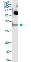 Anti-SFN Antibody Pair