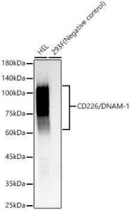 Western blot analysis of various lysates, using Anti-CD226 Antibody [ARC60137] (A309629) at 1:1,000 dilution