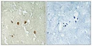 Immunohistochemical analysis of paraffin-embedded human brain using Anti-PARK7 Antibody 1:100 (4°C overnight). The right hand panel represents a negative control, where the antibody was pre-incubated with the immunising peptide