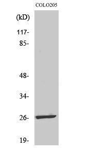 Anti-LDOC1L Rabbit Polyclonal Antibody