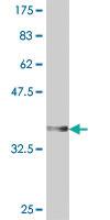 Anti-DPYSL4 Mouse Polyclonal Antibody