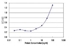 Anti-HOXB9 Antibody Pair