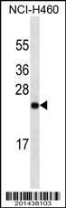 Anti-UCHL1 Mouse Monoclonal Antibody (APC (Allophycocyanin)) [clone: 346CT2.2.1]