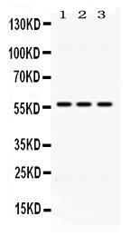 Anti-ALDH1B1 Rabbit Polyclonal Antibody