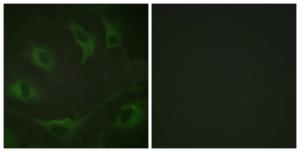 Antibody anti-CBL phospho TYR774 100 µg