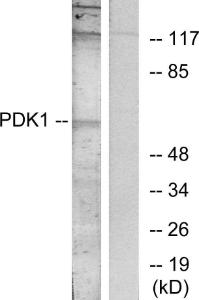 Western blot analysis of lysates from MDA-MB-435 cells, treated with EGF using Anti-PDK1 Antibody. The right hand lane represents a negative control, where the antibody is blocked by the immunising peptide