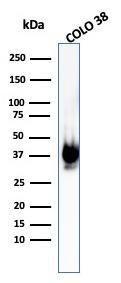 Western blot analysis of COLO-38 cell lysate using Anti-Melanoma gp100 Antibody [PMEL/1825R]