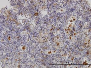 Anti-FGR Mouse Monoclonal Antibody [clone: 3G10]