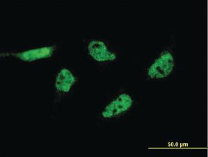 Anti-FAM215A Mouse Monoclonal Antibody [clone: 6D11]