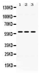 Anti-ALDH7A1 Rabbit Polyclonal Antibody