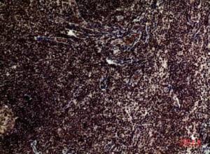 Immunohistochemical analysis of paraffin-embedded human tonsilla using Anti-TERT Antibody