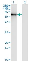 Anti-STK33 Mouse Monoclonal Antibody [clone: 4F7]