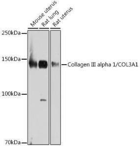 Western blot analysis of extracts of various cell lines, using Anti-Collagen III Antibody [ARC2542] (A308101) at 1:1,000 dilution The secondary antibody was Goat Anti-Rabbit IgG H&L Antibody (HRP) at 1:10,000 dilution Lysates/proteins were present at 25 µg per lane