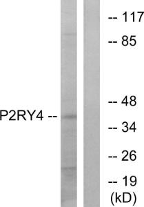 Anti-P2Y4 Rabbit Polyclonal Antibody