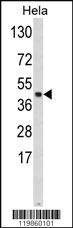 Anti-SKP2 Rabbit Polyclonal Antibody