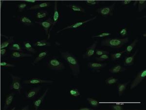 Anti-LMO4 Mouse Monoclonal Antibody [clone: 2B6]