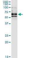 Anti-DPYSL4 Mouse Monoclonal Antibody