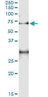 Anti-ACD Antibody Pair