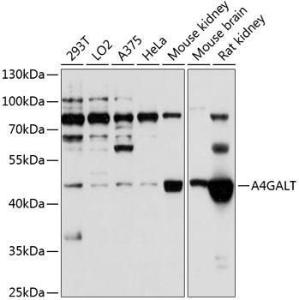 Anti-A4GALT antibody