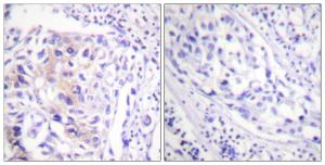 Antibody anti-CBL phospho TYR774 100 µg