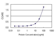 Anti-HSD3B1 Antibody Pair