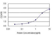 Anti-MAGEA11 Polyclonal Antibody Pair