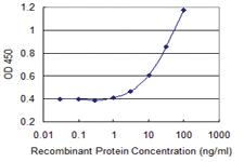 Anti-LMO4 Mouse Monoclonal Antibody [clone: 2B6]