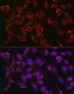 Immunofluorescence analysis of RD cells using Anti-Collagen III Antibody [ARC2542] (A308101) at a dilution of 1:100 DAPI was used to stain the cell nuclei (blue)